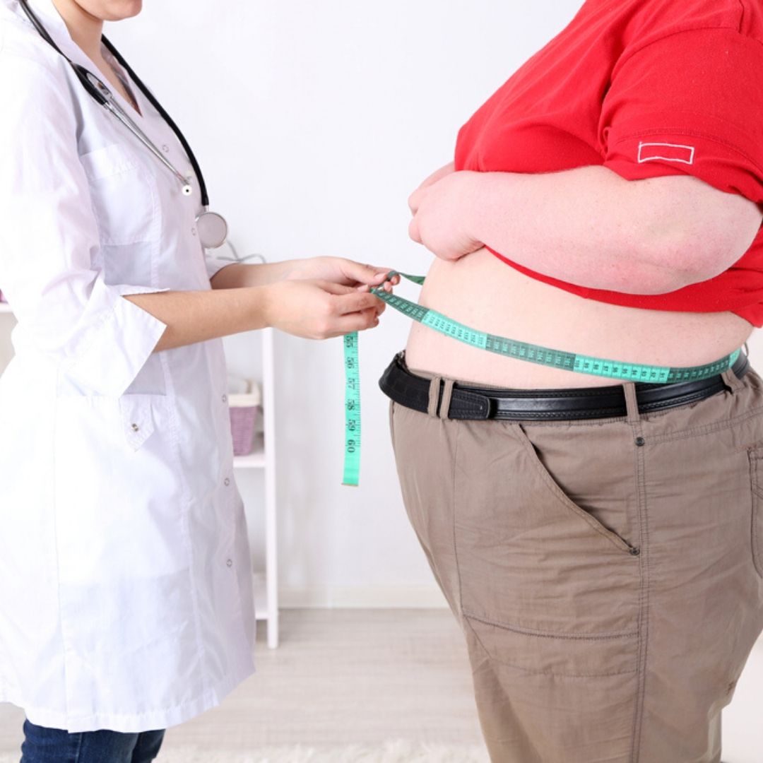 You are currently viewing The effect of obesity on the body