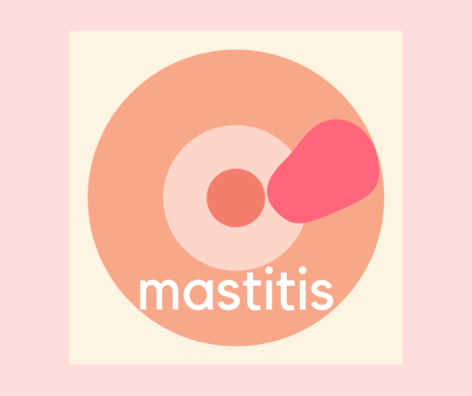 You are currently viewing Mastitis: How to best manage it
