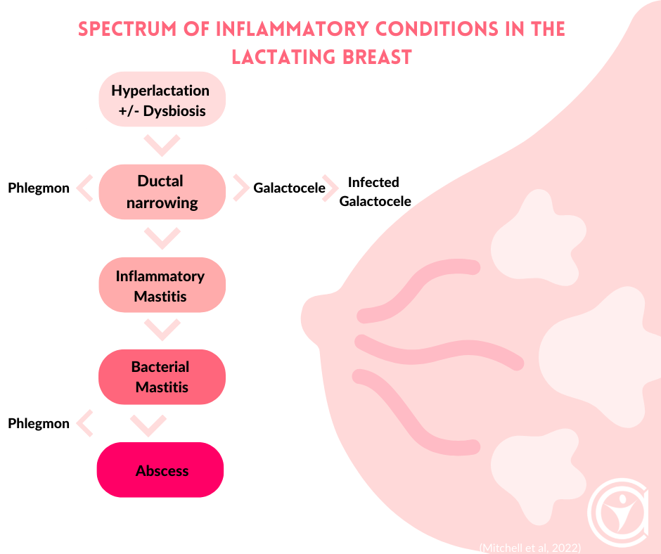 Mastitis - Symptoms, Treatment & Causes