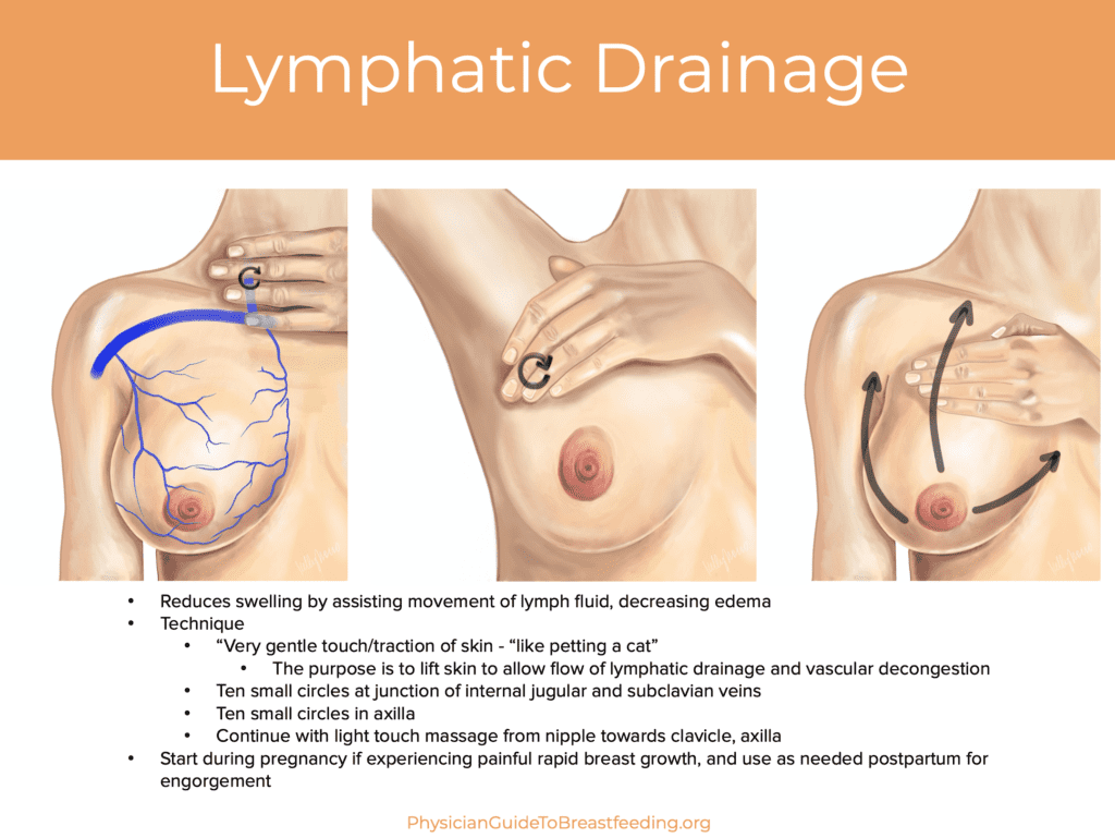 Mastitis lymphatic draiage